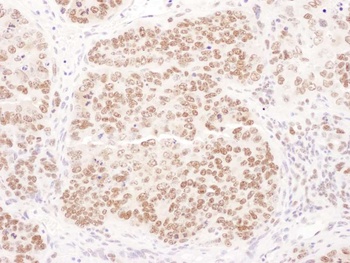 Rabbit PolD1 Antibody