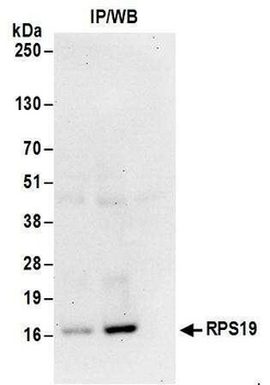 Rabbit RPS19 Antibody