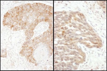 Rabbit TS Antibody