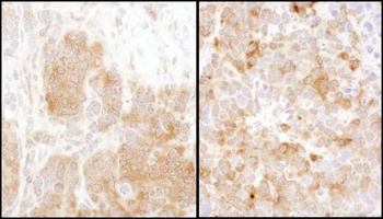 Rabbit TS Antibody
