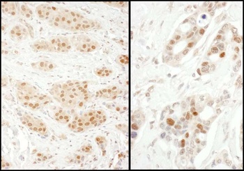 Rabbit Exportin-5 Antibody