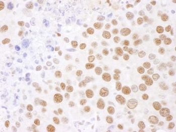 Rabbit SF3B4 Antibody