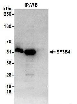 Rabbit SF3B4 Antibody
