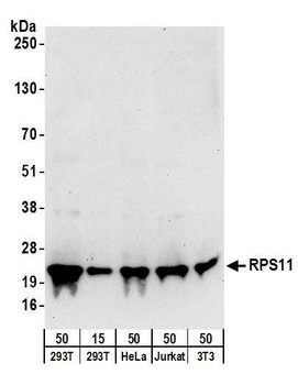 Rabbit RPS11 Antibody