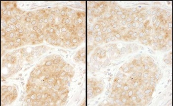 Rabbit RPS11 Antibody