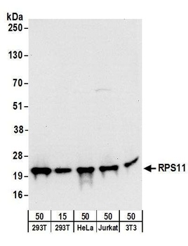 Rabbit RPS11 Antibody