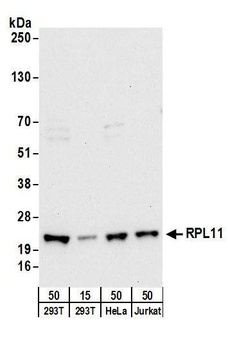 Rabbit RPL11 Antibody