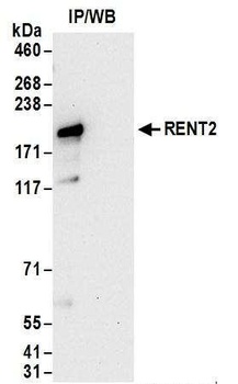 Rabbit RENT2 Antibody