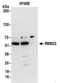 Rabbit RBM22 Antibody