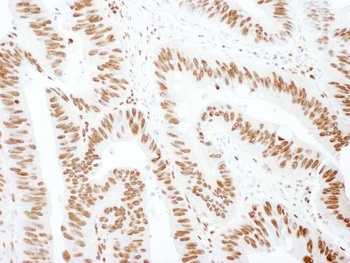 Rabbit hnRNP M3/4 Antibody