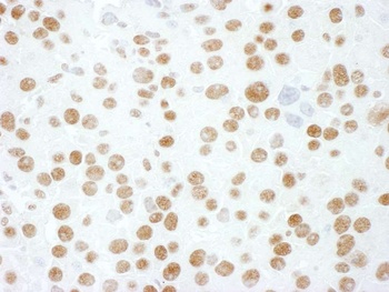 Rabbit hnRNP M3/4 Antibody