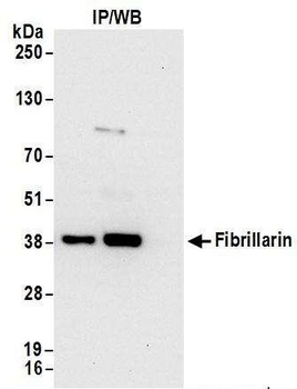 Rabbit Fibrillarin Antibody