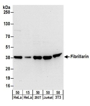 Rabbit Fibrillarin Antibody