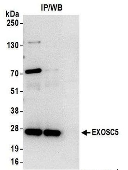 Rabbit EXOSC5 Antibody