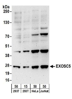Rabbit EXOSC5 Antibody