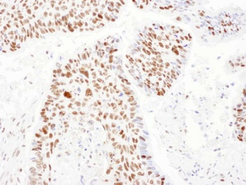 Rabbit PSME3 Antibody