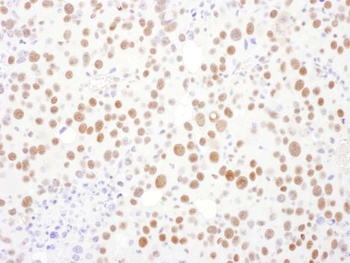Rabbit PSME3 Antibody