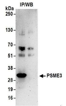 Rabbit PSME3 Antibody