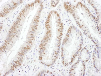 Goat BRG1/SMARCA4 Antibody