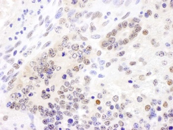 Rabbit Cul4B Antibody