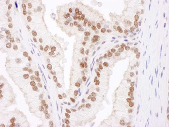 Rabbit Cul4B Antibody