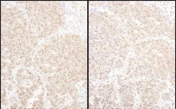 Rabbit PSMD4 Antibody