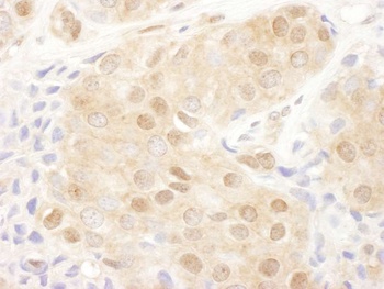 Rabbit PSMD2 Antibody
