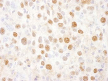 Rabbit PSMD2 Antibody