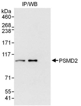 Rabbit PSMD2 Antibody