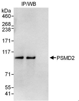 Rabbit PSMD2 Antibody