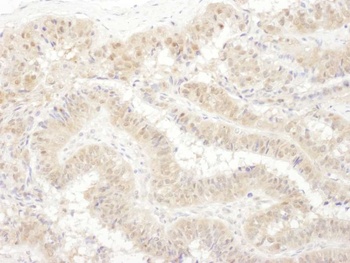 Rabbit PSMC4 Antibody