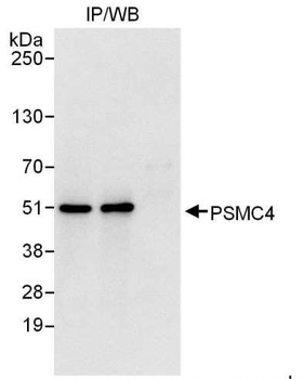 Rabbit PSMC4 Antibody