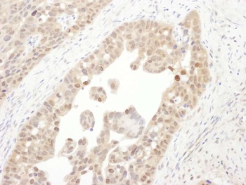 Rabbit PSMC4 Antibody