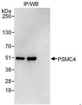 Rabbit PSMC4 Antibody