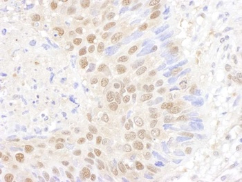 Rabbit PSMB7 Antibody