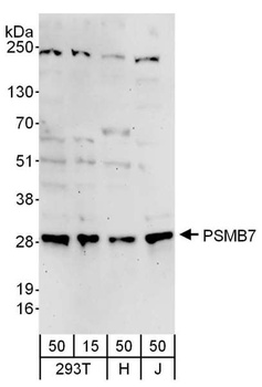 Rabbit PSMB7 Antibody