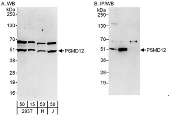 Rabbit PSMD12 Antibody