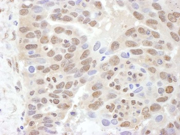 Rabbit PSMC2 Antibody