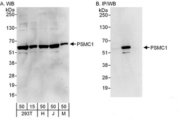 Rabbit PSMC1 Antibody