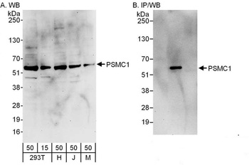 Rabbit PSMC1 Antibody