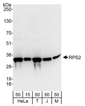Rabbit RPS2 Antibody