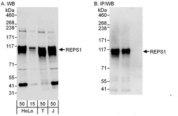 Rabbit REPS1 Antibody