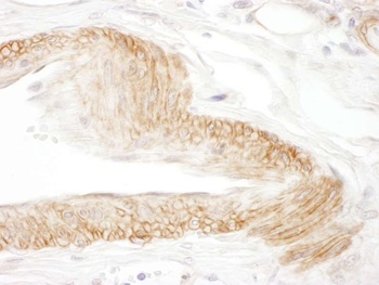 Rabbit JAM-C Antibody