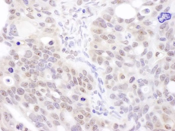 Rabbit Coilin Antibody