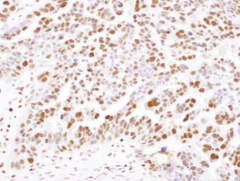 Rabbit SAMHD1 Antibody