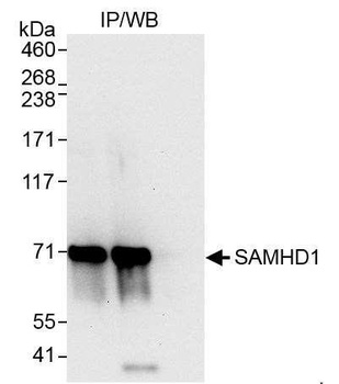 Rabbit SAMHD1 Antibody