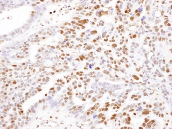 Rabbit SAMHD1 Antibody