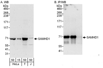 Rabbit SAMHD1 Antibody
