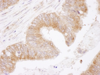 Rabbit Bcl-2 Antibody