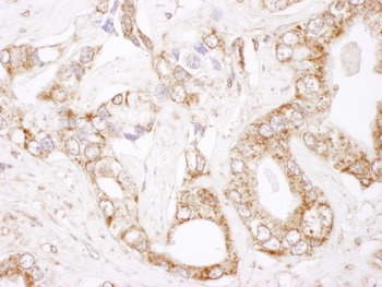 Rabbit Bcl-2 Antibody